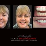 Vogue Smiles Melbourne - Vogue Dentist - Vogue Dental Melbourne -Best Cosmetic dentist in Melbourne CBD