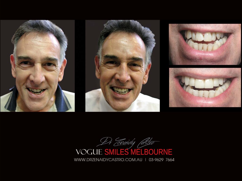 Vogue Smiles Melbourne - Vogue Dentist - Vogue Dental Melbourne -Best Cosmetic dentist in Melbourne CBD