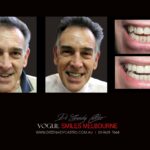 Vogue Smiles Melbourne - Vogue Dentist - Vogue Dental Melbourne -Best Cosmetic dentist in Melbourne CBD
