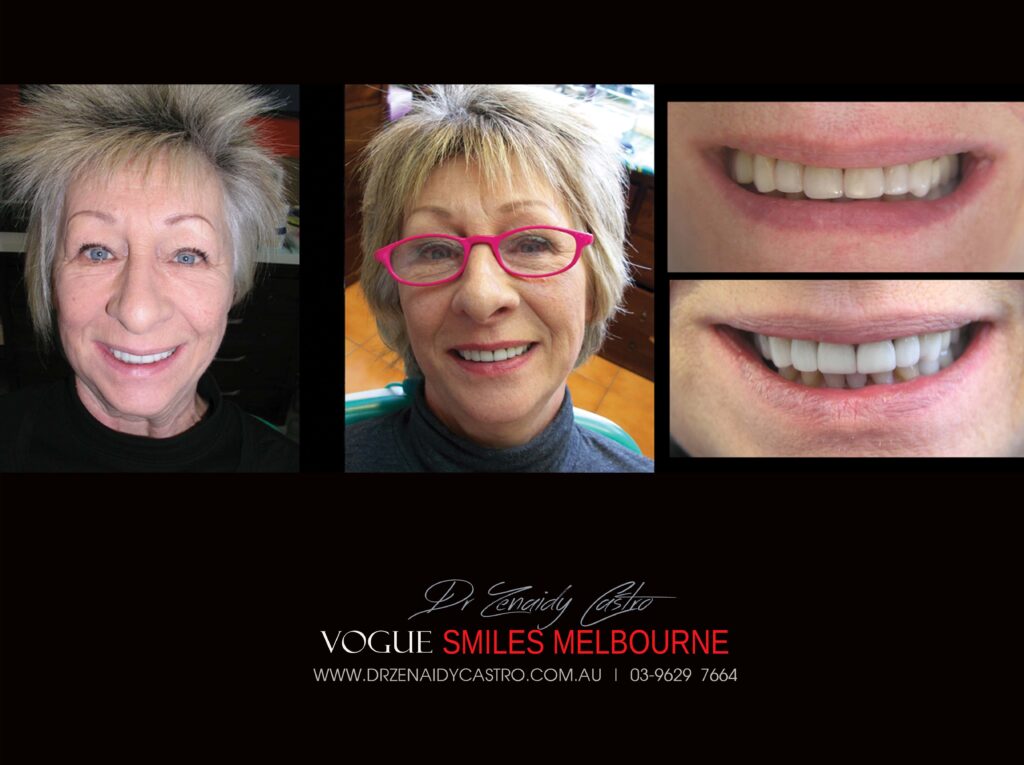 Vogue Smiles Melbourne - Vogue Dentist - Vogue Dental Melbourne -Best Cosmetic dentist in Melbourne CBD