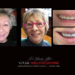 VOGUE-SMILES-COSMETIC-DENTISTRY-TREATMENT-29-scaled.jpg