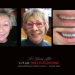 Vogue Smiles Melbourne - Vogue Dentist - Vogue Dental Melbourne -Best Cosmetic dentist in Melbourne CBD