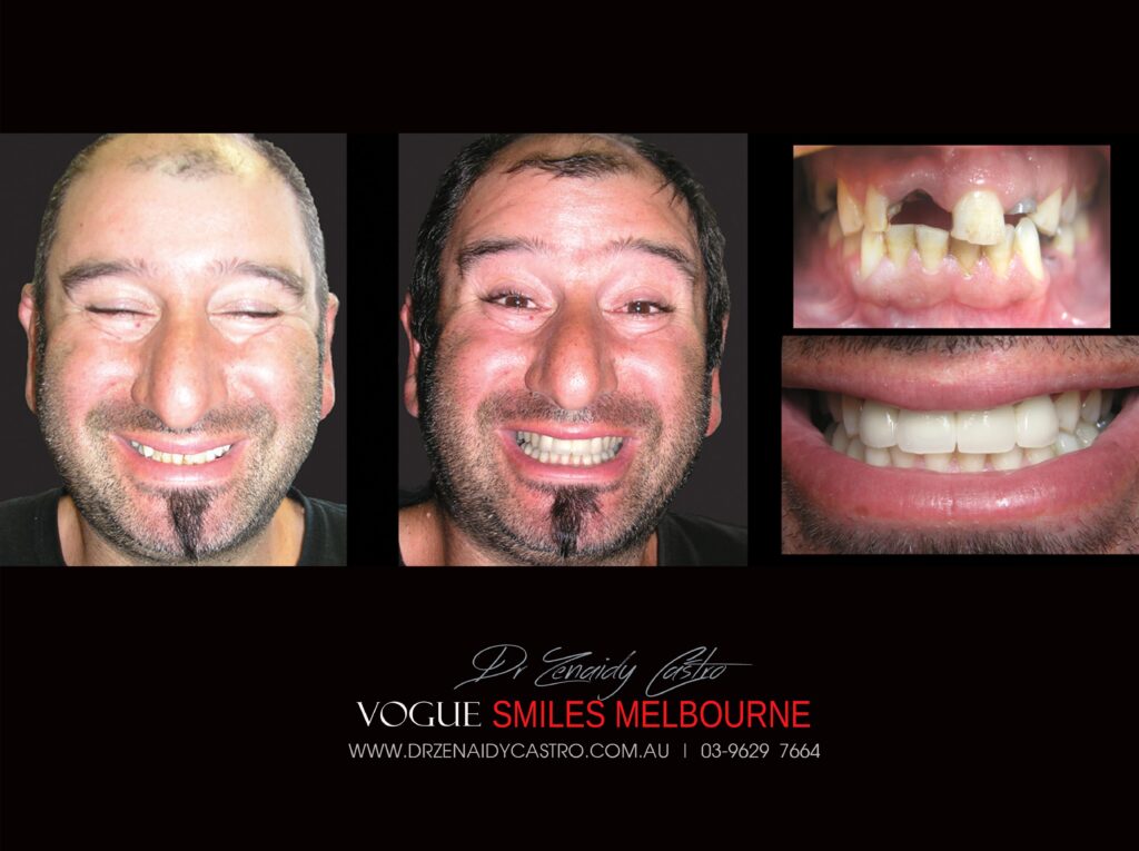 Vogue Smiles Melbourne - Vogue Dentist - Vogue Dental Melbourne -Best Cosmetic dentist in Melbourne CBD