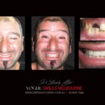 Vogue Smiles Melbourne - Vogue Dentist - Vogue Dental Melbourne -Best Cosmetic dentist in Melbourne CBD