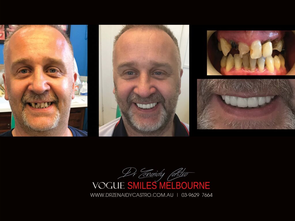 Vogue Smiles Melbourne - Vogue Dentist - Vogue Dental Melbourne -Best Cosmetic dentist in Melbourne CBD
