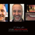 Vogue Smiles Melbourne - Vogue Dentist - Vogue Dental Melbourne -Best Cosmetic dentist in Melbourne CBD