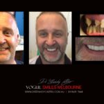 VOGUE-SMILES-COSMETIC-DENTISTRY-TREATMENT-30-scaled.jpg