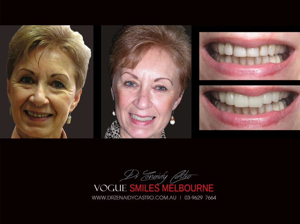 Vogue Smiles Melbourne - Vogue Dentist - Vogue Dental Melbourne -Best Cosmetic dentist in Melbourne CBD