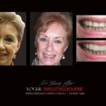 Vogue Smiles Melbourne - Vogue Dentist - Vogue Dental Melbourne -Best Cosmetic dentist in Melbourne CBD