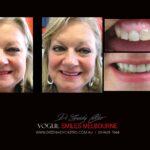 Vogue Smiles Melbourne - Vogue Dentist - Vogue Dental Melbourne -Best Cosmetic dentist in Melbourne CBD