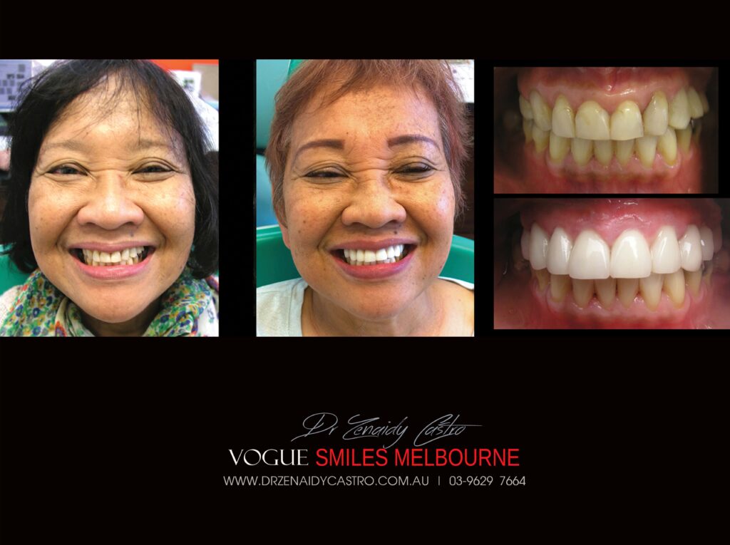 Vogue Smiles Melbourne - Vogue Dentist - Vogue Dental Melbourne -Best Cosmetic dentist in Melbourne CBD