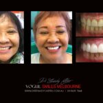 Vogue Smiles Melbourne - Vogue Dentist - Vogue Dental Melbourne -Best Cosmetic dentist in Melbourne CBD
