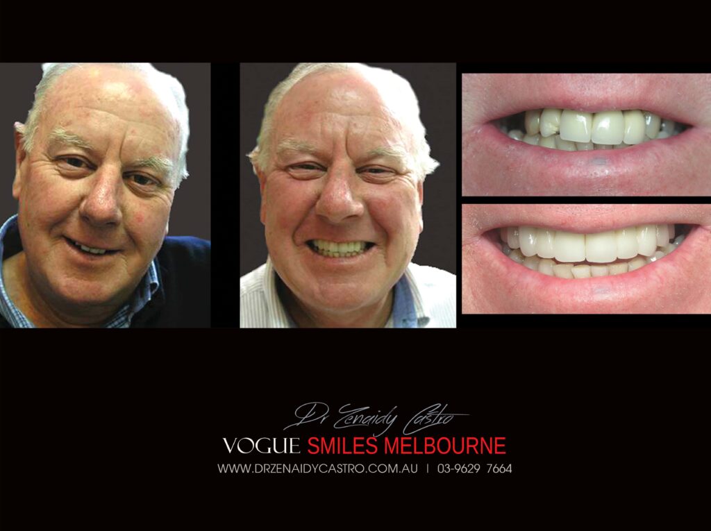 Vogue Smiles Melbourne - Vogue Dentist - Vogue Dental Melbourne -Best Cosmetic dentist in Melbourne CBD