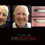 Vogue Smiles Melbourne - Vogue Dentist - Vogue Dental Melbourne -Best Cosmetic dentist in Melbourne CBD