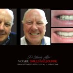 VOGUE-SMILES-COSMETIC-DENTISTRY-TREATMENT-34-scaled.jpg