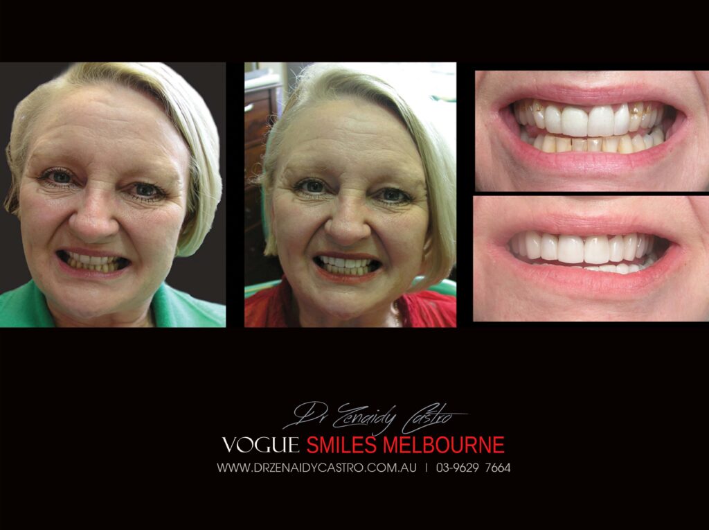 Vogue Smiles Melbourne - Vogue Dentist - Vogue Dental Melbourne -Best Cosmetic dentist in Melbourne CBD