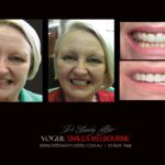 Vogue Smiles Melbourne - Vogue Dentist - Vogue Dental Melbourne -Best Cosmetic dentist in Melbourne CBD
