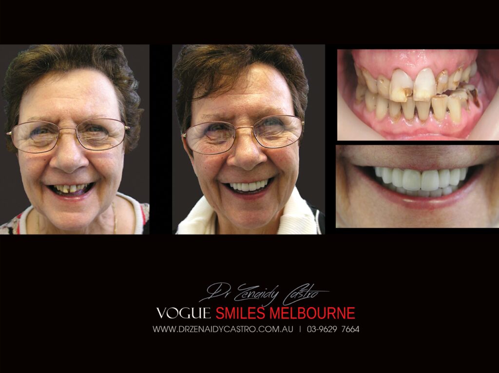 Vogue Smiles Melbourne - Vogue Dentist - Vogue Dental Melbourne -Best Cosmetic dentist in Melbourne CBD
