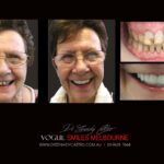 Vogue Smiles Melbourne - Vogue Dentist - Vogue Dental Melbourne -Best Cosmetic dentist in Melbourne CBD
