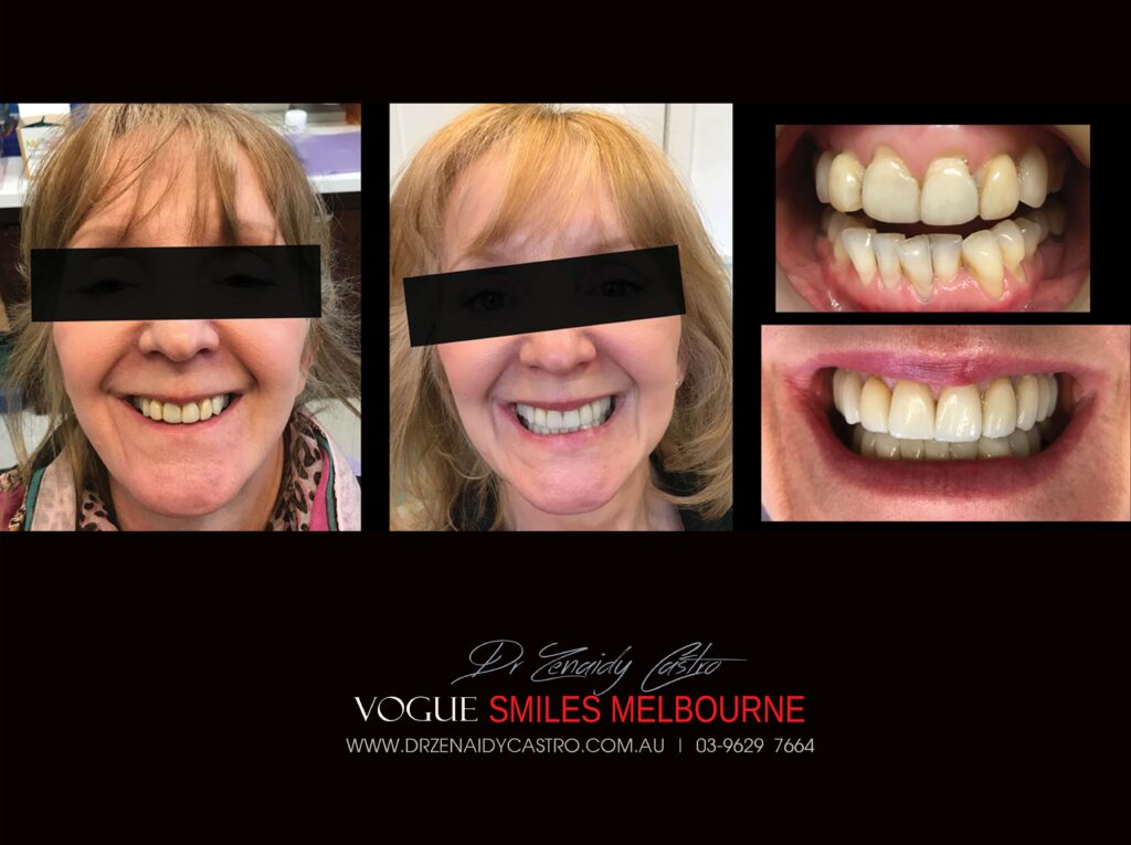 Vogue Smiles Melbourne - Vogue Dentist - Vogue Dental Melbourne -Best Cosmetic dentist in Melbourne CBD
