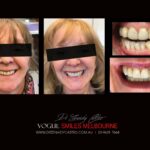 Vogue Smiles Melbourne - Vogue Dentist - Vogue Dental Melbourne -Best Cosmetic dentist in Melbourne CBD