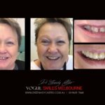 Vogue Smiles Melbourne - Vogue Dentist - Vogue Dental Melbourne -Best Cosmetic dentist in Melbourne CBD