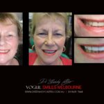 Vogue Smiles Melbourne - Vogue Dentist - Vogue Dental Melbourne -Best Cosmetic dentist in Melbourne CBD
