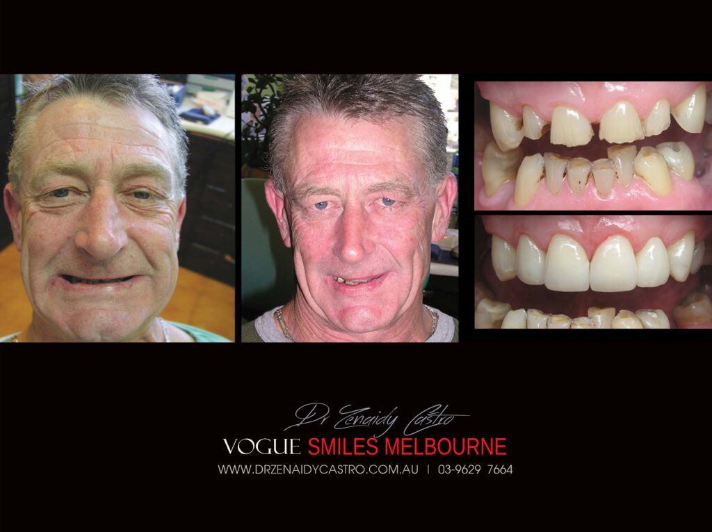Vogue Smiles Melbourne - Vogue Dentist - Vogue Dental Melbourne -Best Cosmetic dentist in Melbourne CBD