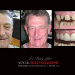 VOGUE-SMILES-COSMETIC-DENTISTRY-TREATMENT-41-scaled.jpg