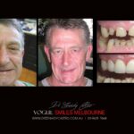 Vogue Smiles Melbourne - Vogue Dentist - Vogue Dental Melbourne -Best Cosmetic dentist in Melbourne CBD