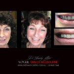 Vogue Smiles Melbourne - Vogue Dentist - Vogue Dental Melbourne -Best Cosmetic dentist in Melbourne CBD