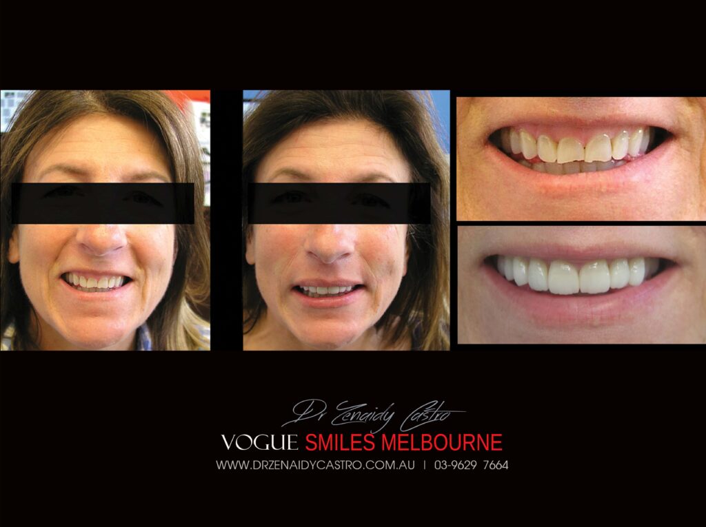 Vogue Smiles Melbourne - Vogue Dentist - Vogue Dental Melbourne -Best Cosmetic dentist in Melbourne CBD