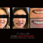 Vogue Smiles Melbourne - Vogue Dentist - Vogue Dental Melbourne -Best Cosmetic dentist in Melbourne CBD