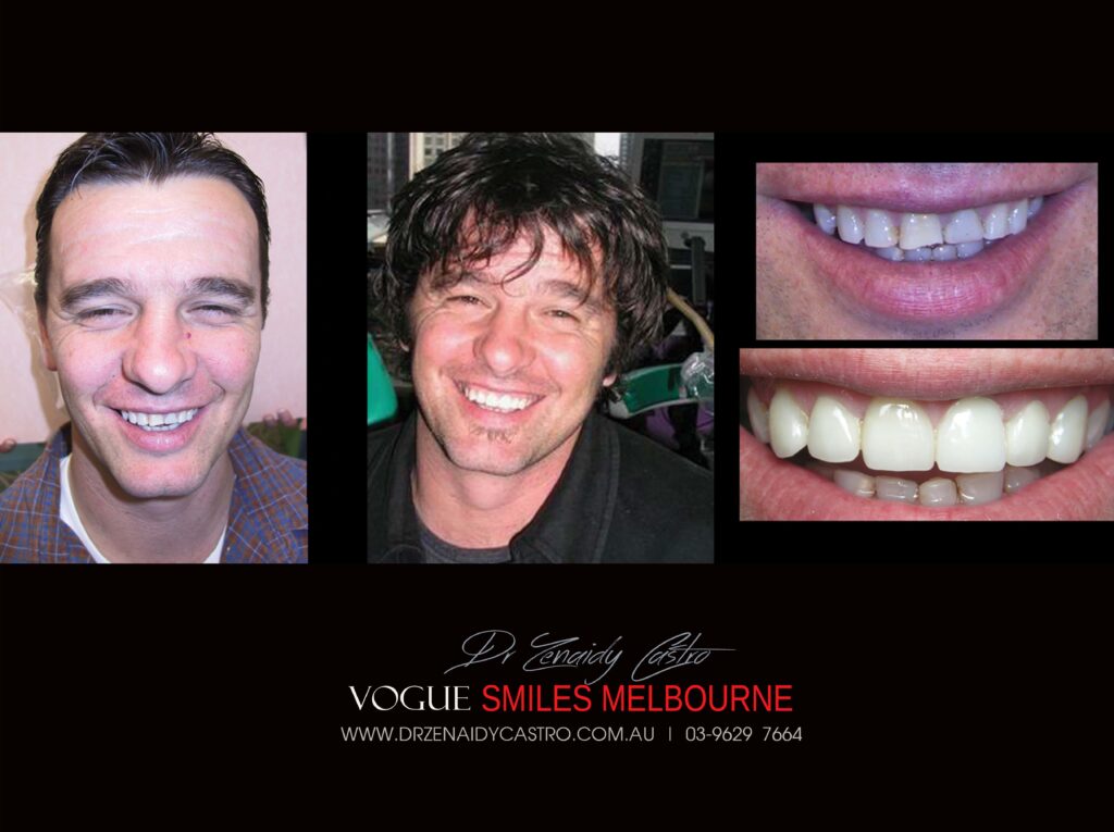 Vogue Smiles Melbourne - Vogue Dentist - Vogue Dental Melbourne -Best Cosmetic dentist in Melbourne CBD