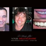 Vogue Smiles Melbourne - Vogue Dentist - Vogue Dental Melbourne -Best Cosmetic dentist in Melbourne CBD