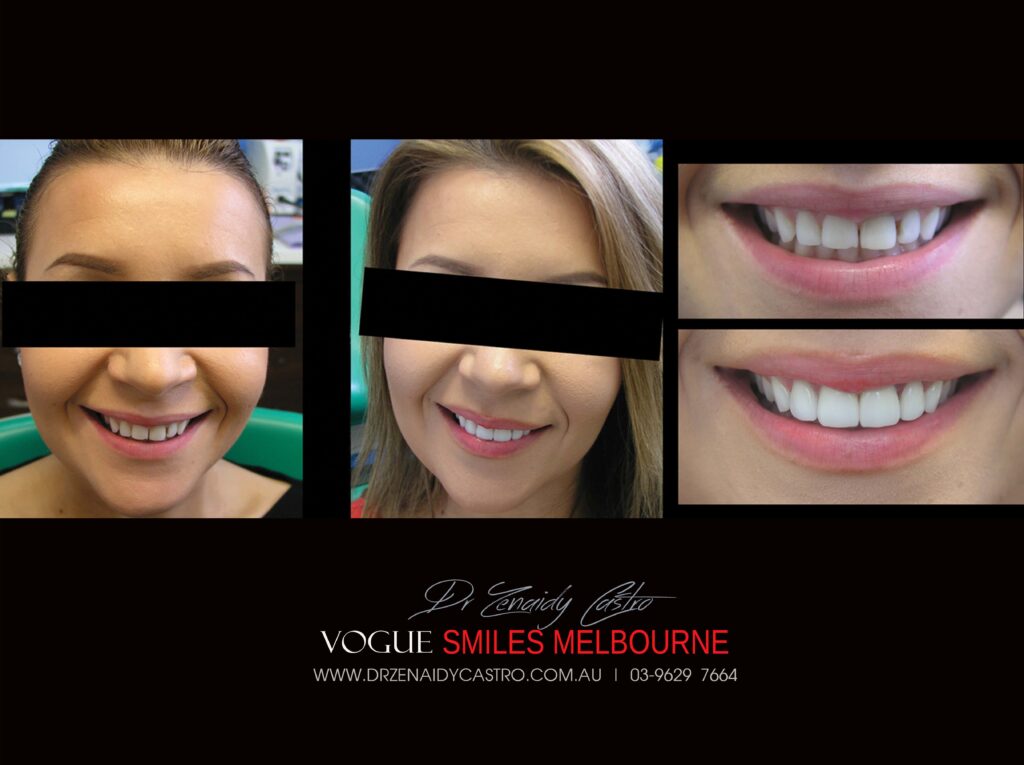 Vogue Smiles Melbourne - Vogue Dentist - Vogue Dental Melbourne -Best Cosmetic dentist in Melbourne CBD