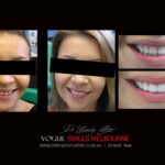 Vogue Smiles Melbourne - Vogue Dentist - Vogue Dental Melbourne -Best Cosmetic dentist in Melbourne CBD