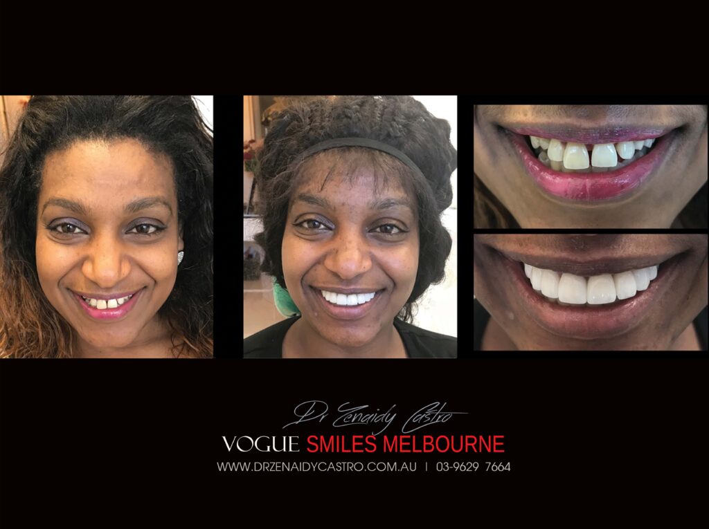 Vogue Smiles Melbourne - Vogue Dentist - Vogue Dental Melbourne -Best Cosmetic dentist in Melbourne CBD