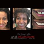 Vogue Smiles Melbourne - Vogue Dentist - Vogue Dental Melbourne -Best Cosmetic dentist in Melbourne CBD