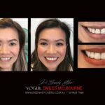 Vogue Smiles Melbourne - Vogue Dentist - Vogue Dental Melbourne -Best Cosmetic dentist in Melbourne CBD