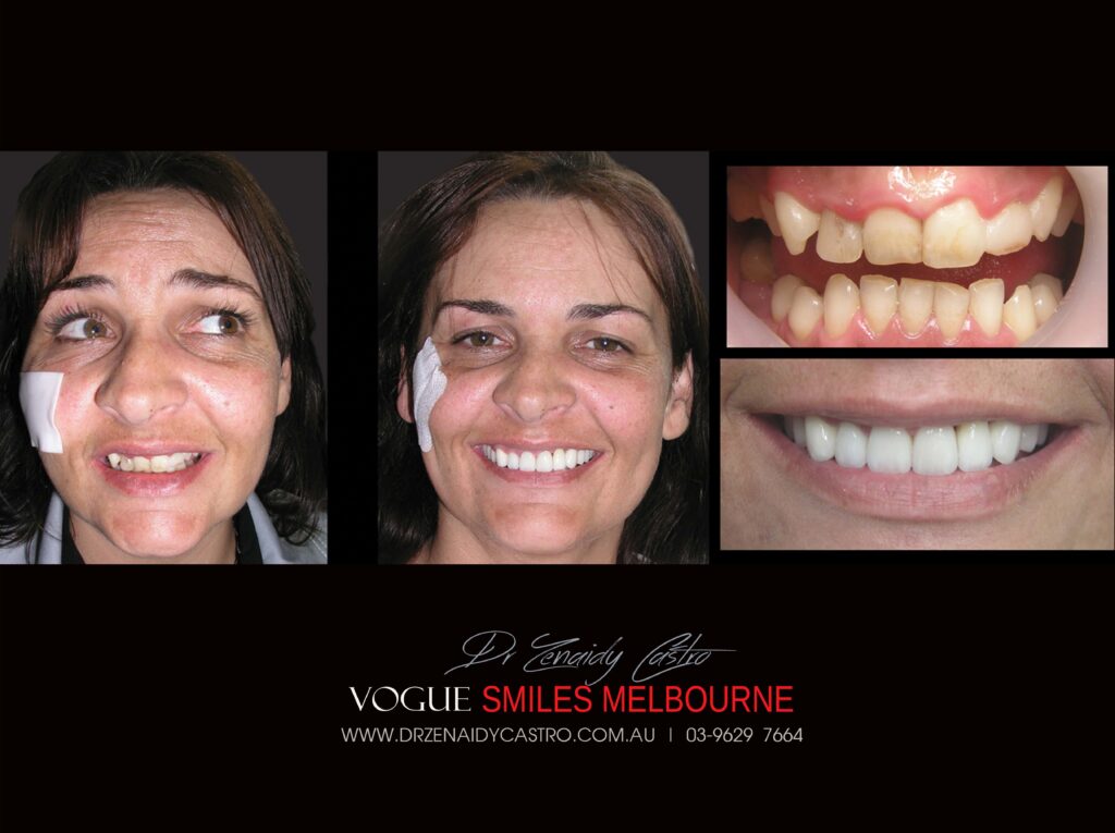 Vogue Smiles Melbourne - Vogue Dentist - Vogue Dental Melbourne -Best Cosmetic dentist in Melbourne CBD