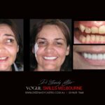 Vogue Smiles Melbourne - Vogue Dentist - Vogue Dental Melbourne -Best Cosmetic dentist in Melbourne CBD