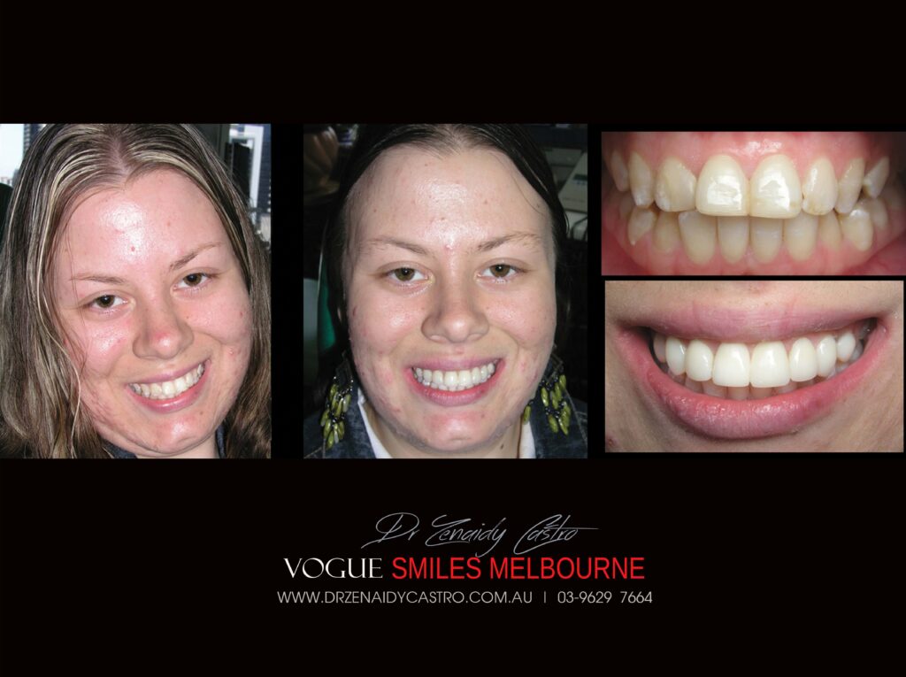 Vogue Smiles Melbourne - Vogue Dentist - Vogue Dental Melbourne -Best Cosmetic dentist in Melbourne CBD