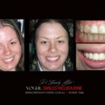 Vogue Smiles Melbourne - Vogue Dentist - Vogue Dental Melbourne -Best Cosmetic dentist in Melbourne CBD