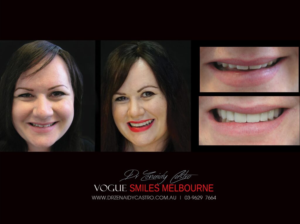 Vogue Smiles Melbourne - Vogue Dentist - Vogue Dental Melbourne -Best Cosmetic dentist in Melbourne CBD