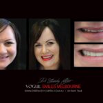 Vogue Smiles Melbourne - Vogue Dentist - Vogue Dental Melbourne -Best Cosmetic dentist in Melbourne CBD