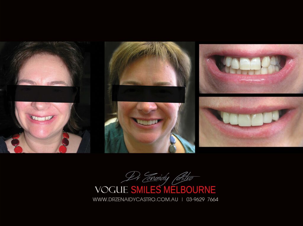 Vogue Smiles Melbourne - Vogue Dentist - Vogue Dental Melbourne -Best Cosmetic dentist in Melbourne CBD