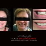 Vogue Smiles Melbourne - Vogue Dentist - Vogue Dental Melbourne -Best Cosmetic dentist in Melbourne CBD