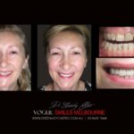 Vogue Smiles Melbourne - Vogue Dentist - Vogue Dental Melbourne -Best Cosmetic dentist in Melbourne CBD