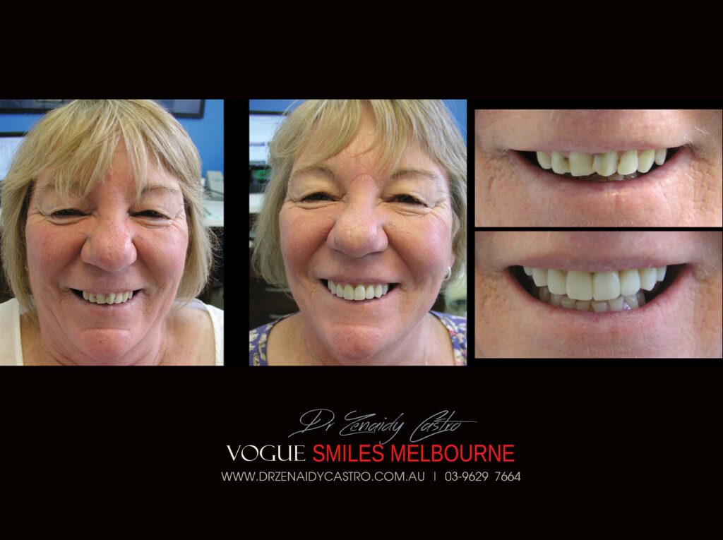 Vogue Smiles Melbourne - Vogue Dentist - Vogue Dental Melbourne -Best Cosmetic dentist in Melbourne CBD
